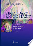 Secondary Rhinoplasty Book