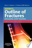 Adams's Outline of Fractures, Including Joint Injuries