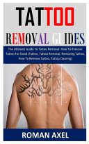 Tattoo Removal Guide