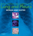 Tumors and Tumor-like Conditions of the Lung and Pleura E-Book