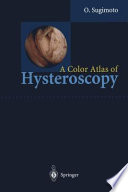 A Color Atlas of Hysteroscopy Book