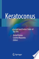 Keratoconus Book