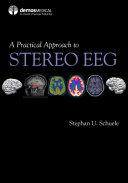 A Practical Approach to Stereo EEG