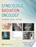 Gynecologic Radiation Oncology  A Practical Guide