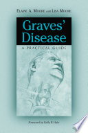 Graves’ Disease