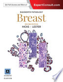 Diagnostic Pathology: Breast E-Book
