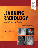Learning radiology : recognizing the basics