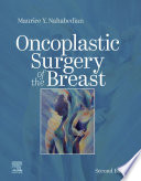 Oncoplastic Surgery of the Breast E Book Book