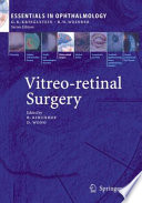 Vitreo retinal Surgery Book