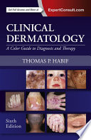 Clinical Dermatology E Book