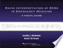Rapid Interpretation of ECGs in Emergency Medicine Book