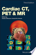 Cardiac CT  PET and MR Book