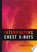 Interpreting Chest X Rays