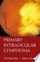 Primary Intraocular Lymphoma