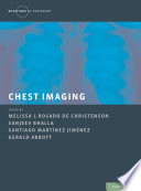 Chest Imaging Book