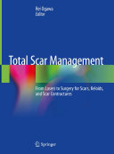 Total Scar Management [Pdf/ePub] eBook