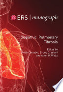 Idiopathic Pulmonary Fibrosis Book