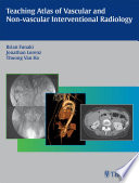 Teaching Atlas of Vascular and Non vascular Interventional Radiology