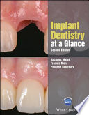 Implant Dentistry at a Glance Book