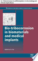 Bio tribocorrosion in biomaterials and medical implants