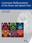 Cavernous Malformations of the Brain and Spinal Cord Book