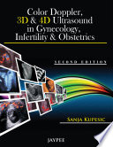 Color Doppler  3D and 4D Ultrasound in Gynecology  Infertility and Obstetrics Book