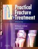 Practical Fracture Treatment [Pdf/ePub] eBook