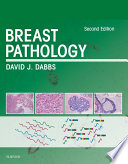 Breast Pathology E Book