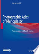 Photographic Atlas of Rhinoplasty