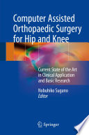 Computer Assisted Orthopaedic Surgery For Hip And Knee