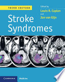 Stroke Syndromes  3ed Book