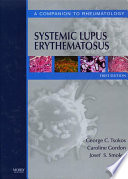 Systemic Lupus Erythematosus E Book