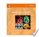 Imaging Of The Brain
