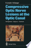 Compressive Optic Nerve Lesions at the Optic Canal Book