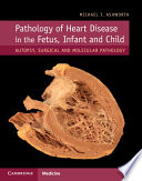 Pathology of Heart Disease in the Fetus  Infant and Child