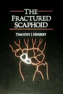 The Fractured Scaphoid Book