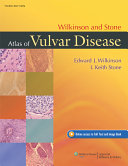 Wilkinson and Stone Atlas of Vulvar Disease