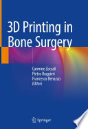 3D Printing in Bone Surgery