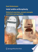 Total Ankle Arthroplasty Book