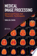 Medical Image Processing Book