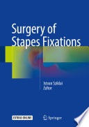 Surgery of Stapes Fixations Book