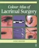 Colour Atlas of Lacrimal Surgery