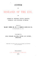 System of Diseases of the Eye: Local diseases, glaucoma, wounds and injuries, operations