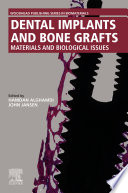 Book Dental Implants and Bone Grafts Cover