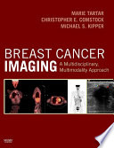 Breast Cancer Imaging E Book