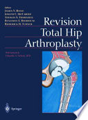Revision Total Hip Arthroplasty Book