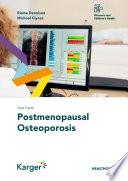 Fast Facts  Postmenopausal Osteoporosis
