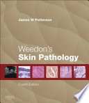 Weedon s Skin Pathology E Book Book