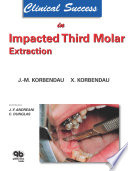 Clinical Success In Impacted Third Molar Extraction