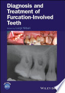 Diagnosis and Treatment of Furcation Involved Teeth Book